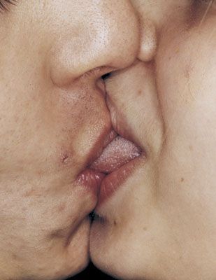 Поцелуи (17 Фото)