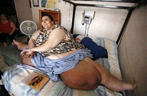 Самый толстый человек в мире (6 Фото)