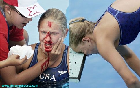 Самые опасные моменты спорта. Осторожно, много жести! (14 Фото)