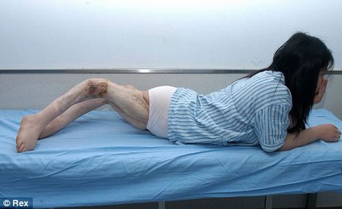Китайская девушка с перекрученными ногами (4 фото)