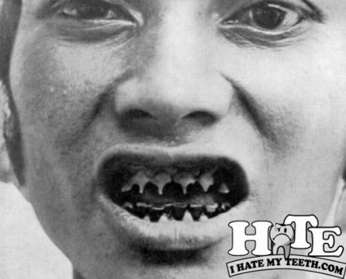 Худшие зубы в мире (31 фото)