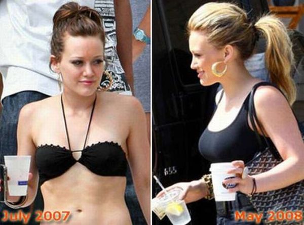 Звезды до и после операций по увеличению груди (10 фото)