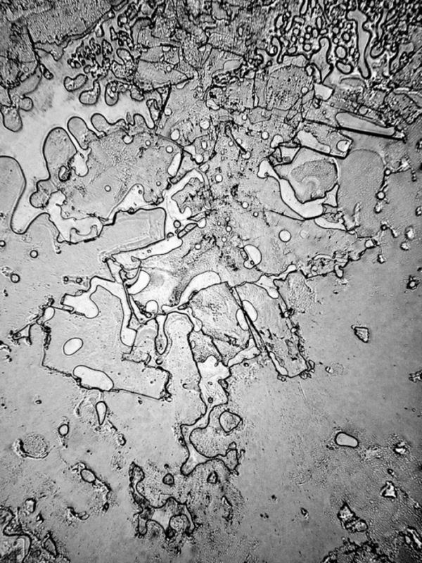 Структура человеческих слёз под электронным микроскопом (7 фото)