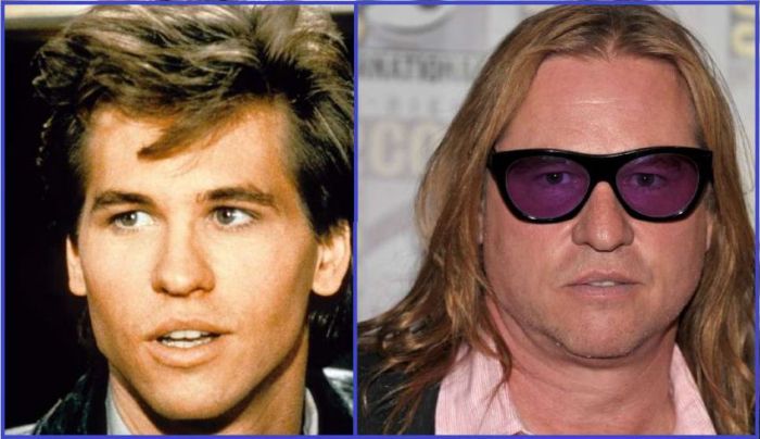Celebrities That Didn't Age Well (28 pics)