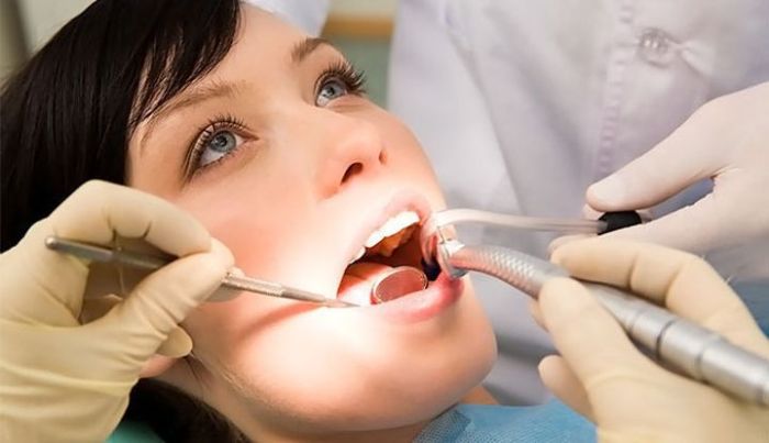 Как осуществляется пломбирование зубов и корневого канала (15 фото)