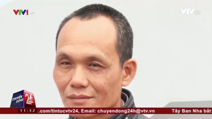 Во Вьетнаме из тела мужчины извлекли зажим, забытый 18 лет назад (3 фото)