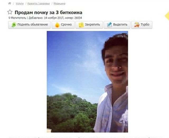 Украинец решил продать свою почку за 3 биткоина 