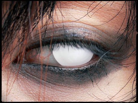 Глаза японских фриков (28 Фото)