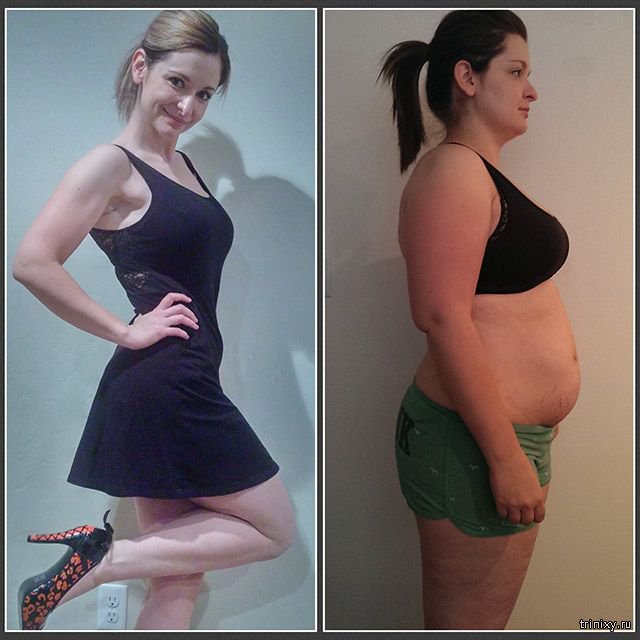 Живот до и после похудения фото женские